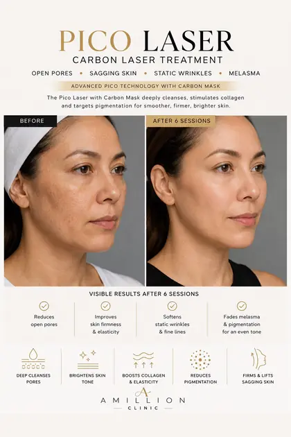 Pico Laser - Carbon laser treatment: before and after treatment guide