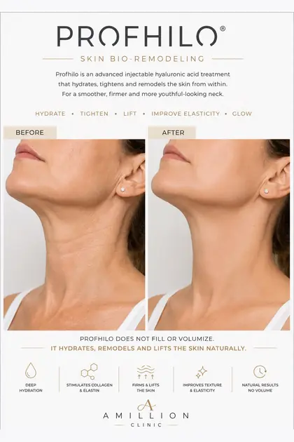 Profhilo® - Skin bio-remodeling — neck: before and after treatment guide